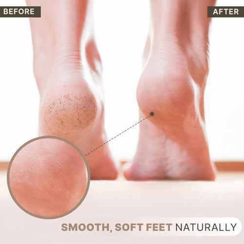 Pumice Stone for Feet - Natural Lava Stone Foot Exfoliator, Callus Remove for Feet, Hands & Dead Skin, Foot Scrubber for Pedicure & Cracked Heels, Strong & Durable Design for Smooth & Soft Feets