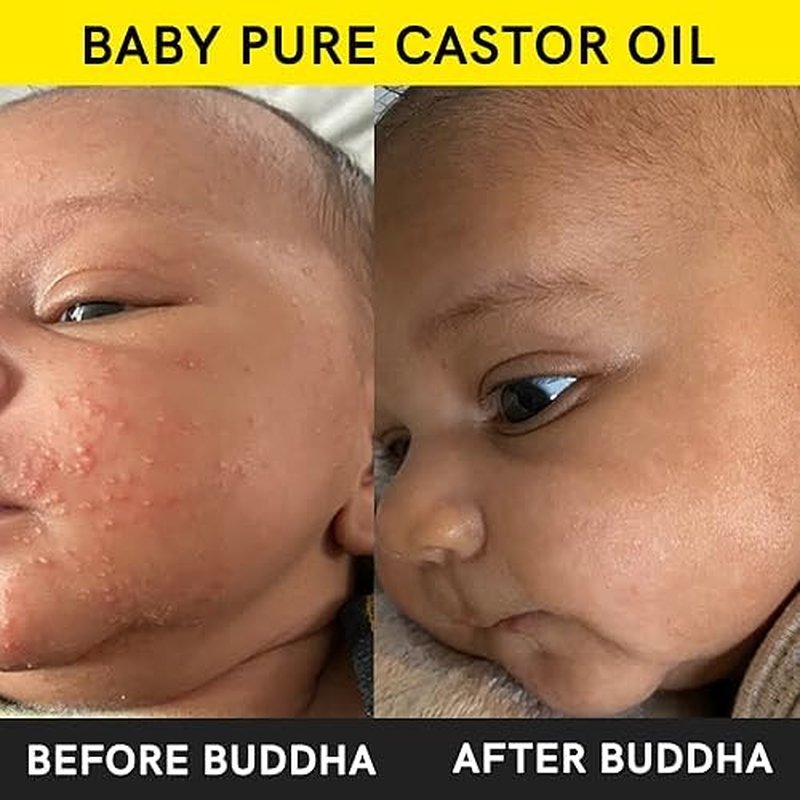 Buddha Natural Baby Castor Oil - Cold Pressed Extra Virgin for Nourishing, Moisturizing, and Soothing Delicate Skin | 150ml
