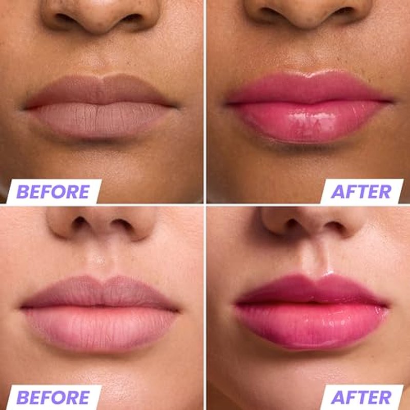 Wonderskin Lip Rehab Serum Oil (Kissed (2 Pack))