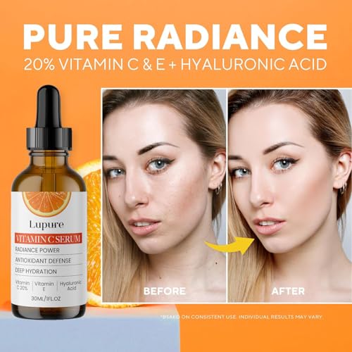 Professional Vitamin C Face Serum 20%, Anti Aging Facial Super Vit C Serum with Ascorbic Acid Hyaluronic Acid & Vitamin E for Dark Spots, Skin Care, Christmas Gift & Stocking | 1 Fl. Oz