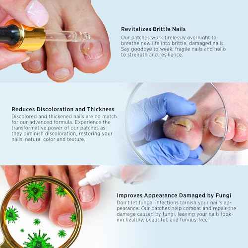 Toenail Fungus Treatment Extra Strength - Nail Fungus Treatment For Toenail Extra Strength - Nighttime Nail Patches & Nail Treatment Liquid Set (32patches+15ml)
