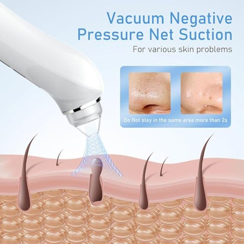 Facial Pore Blackhead Remover Vacuum, 1080P Camera Blackhead Remover, 20x Zoom, 8 LEDs £¦ 3 Suction Modes, 800mAh Battery & USB - 6 Heads Pore Cleaner Kit for Women&Men(White)