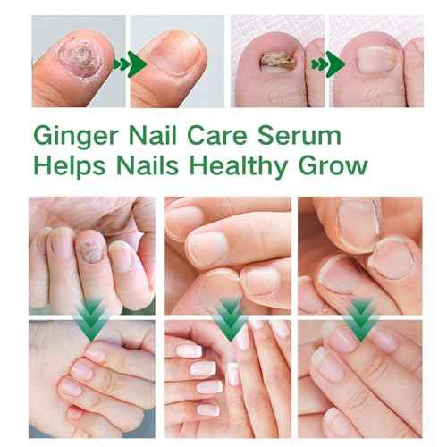 Ginger Nail Treatment Serum - Moisturize the Cuticle & Strengthen Nails and Helps Nails Healthy Grow, 1 fl.oz (Pack of 2)