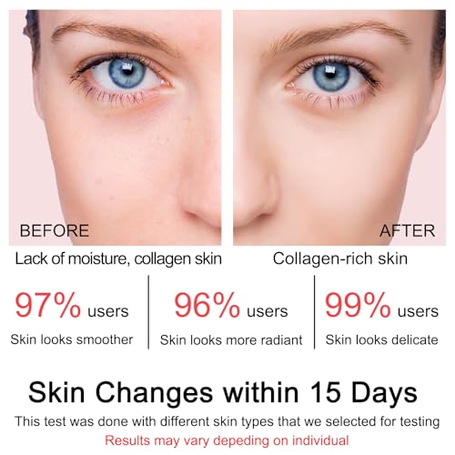 Collagen Jelly Cream - Contains Niacinamide & Freeze Dried Hydrolyzed Collagen -Elasticity & Hydration - Reduce Fine Lines & Dullness - Korean Glass-Shiny Skin Suitable for All Skin Types (3.38 Fl.Oz)