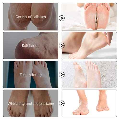 Foot Mask for Dry Cracked Feet, 3 Pairs Feet Peeling Mask, Foot Masks That Remove dead Skin, Callus Remover, Dry, Cracked Skin, Intensely Moisturizes Repairs, Spa Experience, Natural Exfoliator