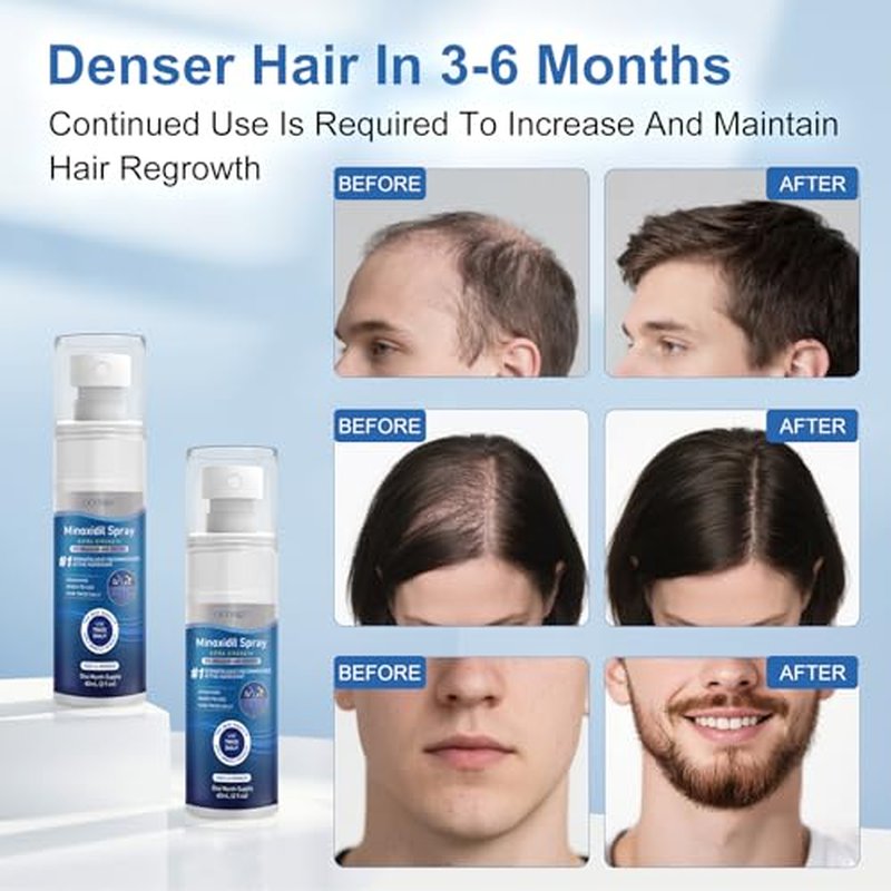 5% Minoxidil for Men and Women, Regrowth Serum, Extra Strength Spray for Hair Loss, Minoxidil 5 Percent, Thicker Healthier Hair, Beard Growth Kit, Topical Treatment, 60ml x 7 Bottles£¨Extra Strength£©