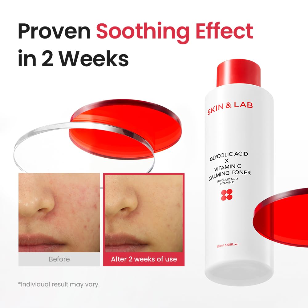 [Skin&LAB] GLYCOLIC Acid X Vitamin C Calming Toner, 6.08 fl. oz.