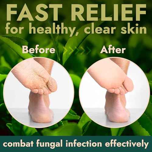 Foot Scrub with Tea Tree Oil | Callus Remover For Feet | Exfoliating Scrub with Salicylic and Glycolic Acid for Dead Skin, Athlete¡¯s Foot, Warts, Corns, Rashes, Foot Odor, Insect Bites and Foot Care