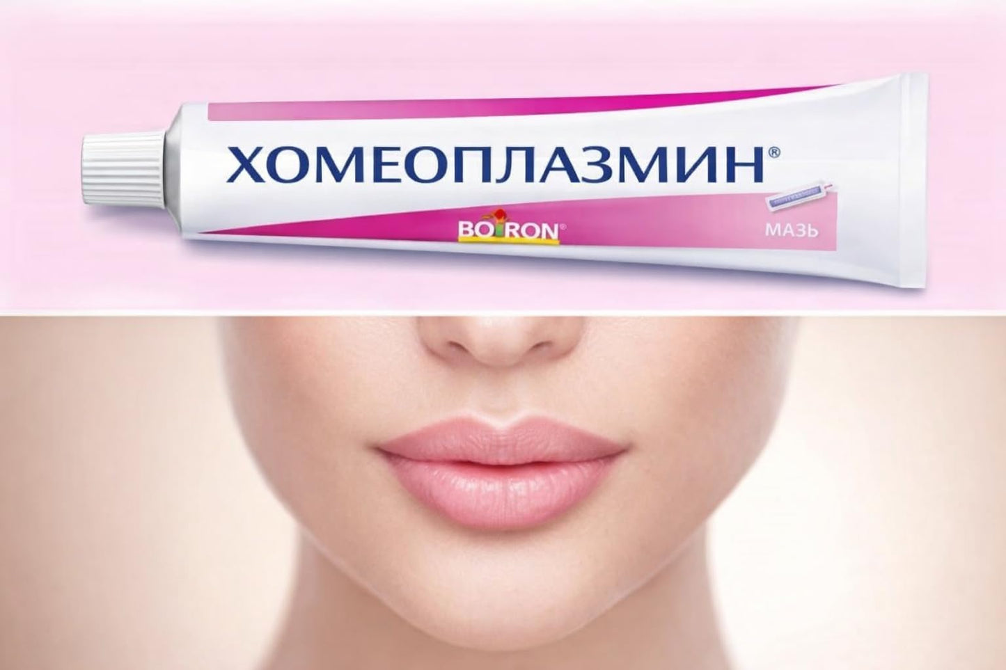 Homeoplasmine, XL - 40g Magic Cream - For Dry Skin, Irritations, for Soft Lips! [ The Original French Packaging ]