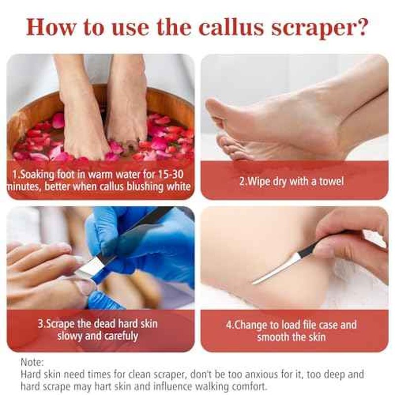 cobee 6 Pcs Ingrown Toenail Removal Kit, Callus Shaver Ingrown Toenail Tool with A Storage Box, Foot Callus Remover Tool Pedicure Knife for Foot Care Dead Skin Corn File Rasp