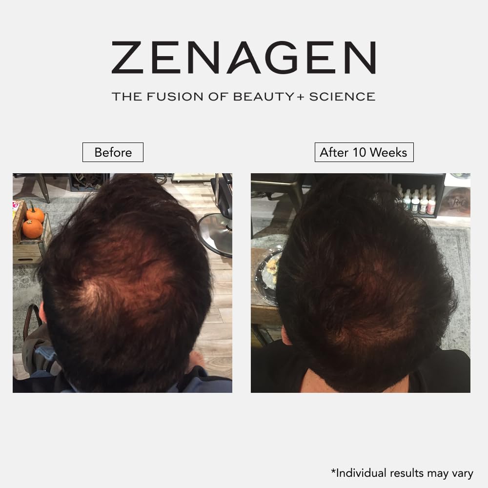 ZENAGEN Revolve Men's Thickening Shampoo | Supports Appearance of Fuller, Healthier-Looking Hair, Developed for Fine & Visibly Thinning Hair, Plant-Based, 5-Minute Treatment, 75 mL / 2.5 oz