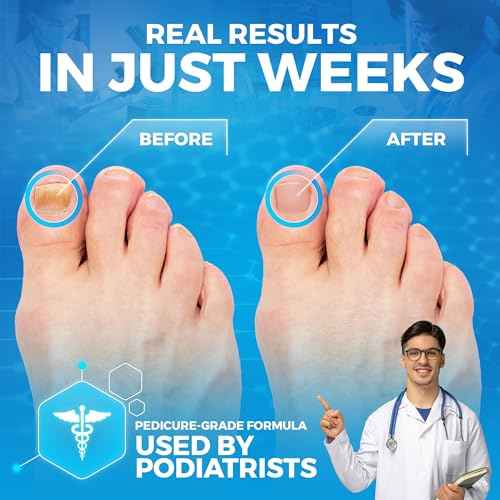 Epsom Salt Foot Soak w Tea Tree for Foot Bath (PEDICURE GRADE) - Toenail Repair, and Fungus Athletes Foot, Softens Calluses, Tired Feet, Nail Discoloration Foot Soak Salts, Smelly Foot Therapy16oz