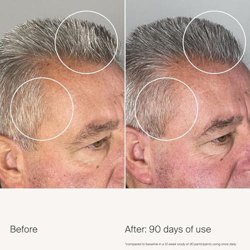 Living Proof Scalp Care Density Serum