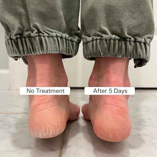 Pedestrian Project Cracked Heel Repair Foot Care Balm, Smooths & Fills Cracks & Rough Skin with Healing Shea & Mango Butters, Vegan, Cruelty Free, 1 oz