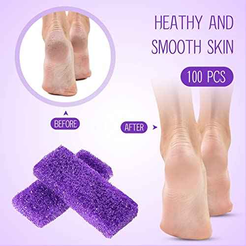 Batiyeer 100 Pcs Pumice Stone for Feet Scrubber Dead Skin Disposable Foot Pumice Foot Shower Scrubber Foot Scrubber for Heel Cuticle Callus Remover Bath Spa (Purple)