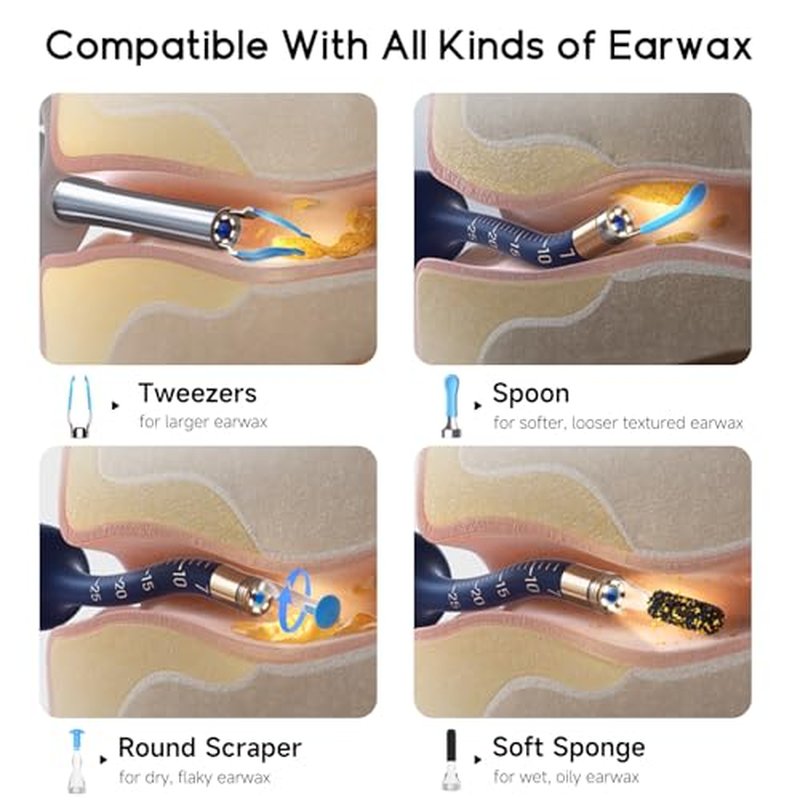 BEBIRD Ear Wax Removal Tool Camera, Visual Earwax Cleaner with Cleaning Kit as Spade/Spoon/Pick/Tweezer Clean Ears for Family, Ear-Scope Otoscope Wireless WiFi Connect