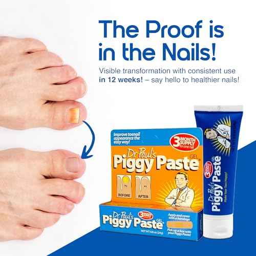 Dr. Paul's Piggy Paste Gel: Fast Acting Solution for Thick, Brittle, Yellow Nails, Restores Clear, Healthy Toenails & Fingernails, Easy, Mess Free Application Doctor Recommended Formula