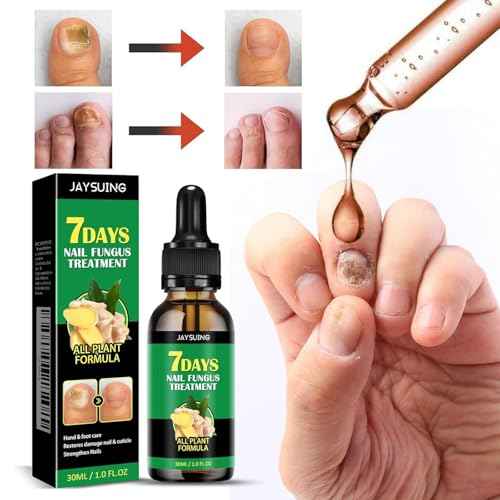 7 days Nail Treatment, Ginger Nail Treatment, Nail Growth Serum, Ginger Nail Serum, Nail Nutrient Oil Strengthener Oil (2 PCS)