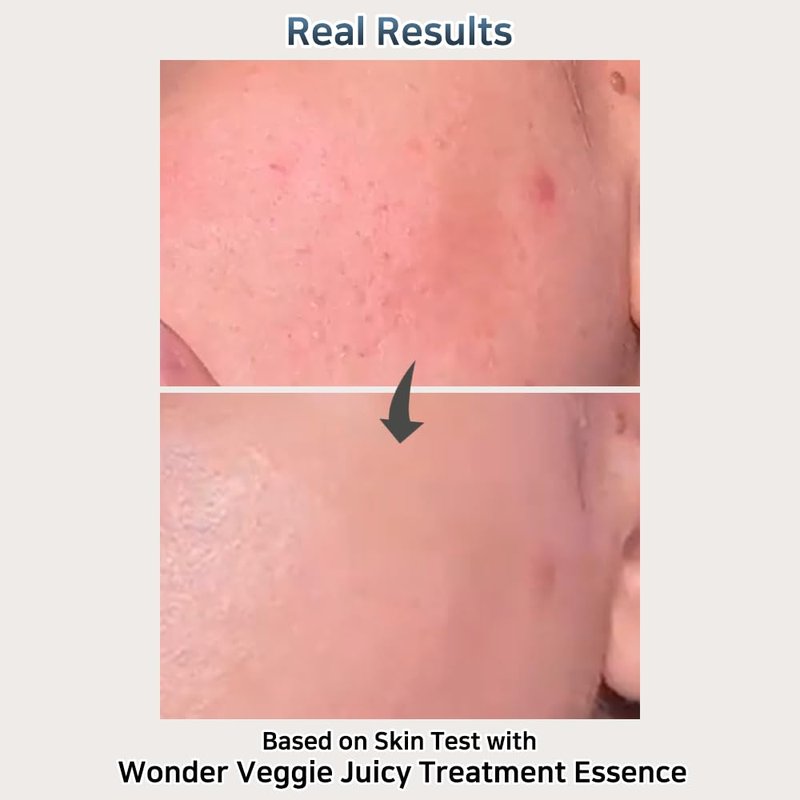 Wonder Veggie Juicy Treatment Essence Toner - Korean Hydrating Toner with Kale Extract for Sensitive Skin | 5.07 fl oz