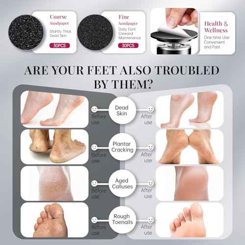 krofaue 1000RPM Electric Callus Remover - Professional Aluminum Foot File Adjustable Pedicure Tool with 60pcs Sandpaper Discs for Dead Skin at Home