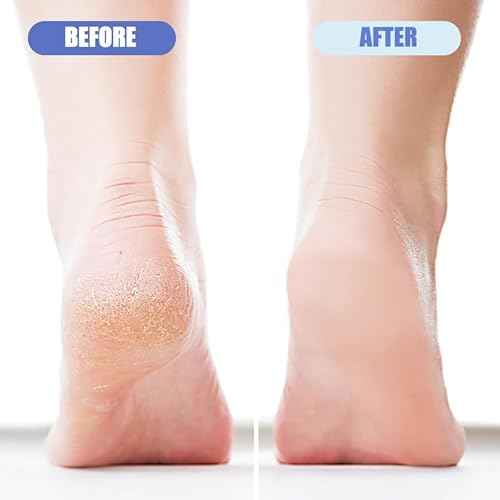 4 Pack Foot Pumice for Feet Pedicure Plastic Foot Scrubber Exfoliator for Dead Skin Cracked Heel Repair Callus Remover