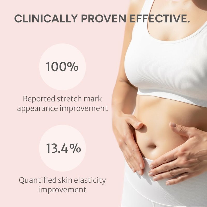Noelo Hills Advanced Stretch Mark Cream for Pregnancy, Weight Gain, Growth Spurts - Pregnancy-Safe - Korean Skincare - Clinically Proven - Ultra Clean Ingredients - Fragrance Free - Vegan - 6.76 fl oz