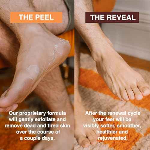 FEETS Foot Peel Mask with Eucalyptus and Lavender (2-Pack) | Remove and Exfoliate Dead Skin | Perfect for Men and Women | Removes and Repairs for Dry, Rough, Cracked Heels and Calluses