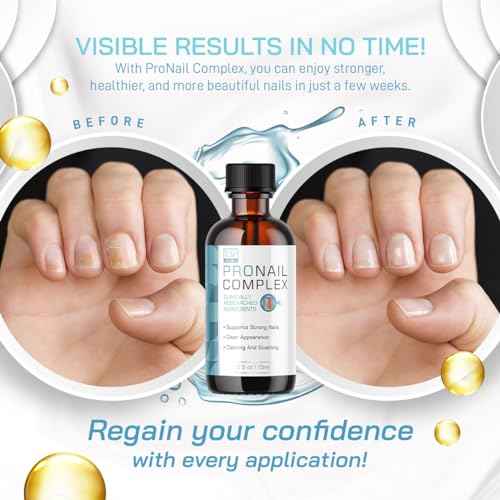 Pronail Complex - Original Formula Toenail Treatment Pronail Complex Liquid Drops Premium Formula Extra Strength, Pro Nail Complex Oil Liquid Drop All Natural Support, 1 Bottle for 1 Month