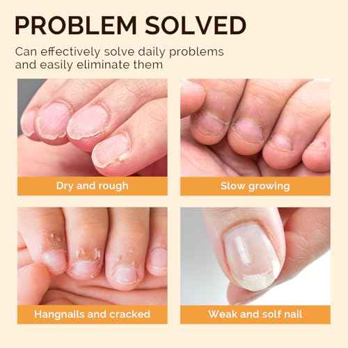 MelodySusie 6Pcs Cuticle Oil Pen Set,Nail Moisturizing Cuticle Oil Enriched with Vitamin E,Softens and Repairs Cuticles,Nail Strengthener,Protects Damaged Skin,Thin Nails,for Home and Salon Use