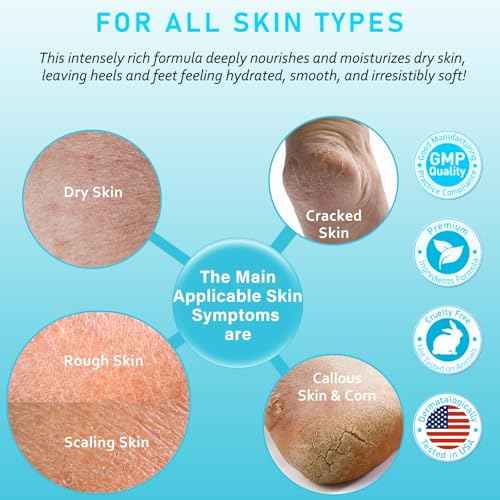 Urea Cream 40 Percent For Feet Maximum Strength - plus Salicylic Acid 2% Foot Cream For Dry Cracked Heels Feet Knees - Dead Skin Cuticle Callus Remover Toenail Softener - Lightly Camellia Scent