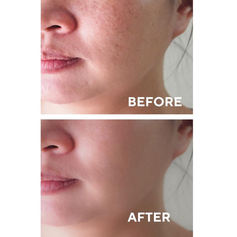 The Ceel Facial Peeling Serum With 10% AHA 2% BHA, Saliscylic Acid Serum for Blemishes, Chemical Peel at Home, Glycolic Acid Peel With Hyaluronic Acid,AHA and BHA, 1.00 fl.oz (30 ml)