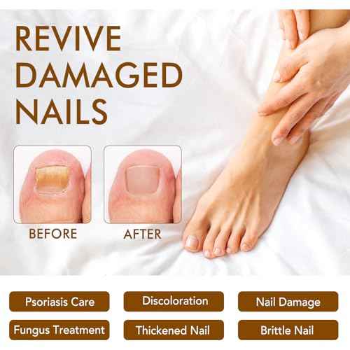 Ginger Nail Treatment, Nail Growth Serum, Nail Repair & Strengthening Oil, Ginger Cuticle Care Oil, Deep Hydration & Nourishing Support for Healthy Nails, 30ml, 2PCS