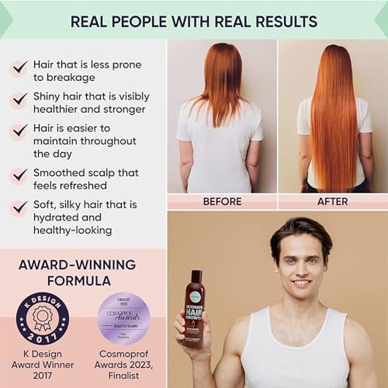 Moerie Ultimate Hair Growth Shampoo ? For Longer, Thicker, Fuller Hair - Vegan Friendly Volumizing Hair Products ? Paraben & Silicone Free ? All Hair Types ? Reverse Hair Loss ? 8.45 fl oz, Triple Set