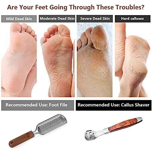 Colossal Foot Rasp & Wood Handle Callus Shaver (10 Replacement & 1 File Foot Heads), Pedicure Foot File Kit, Heel Scraper for Feet, Foot File Callus Remover