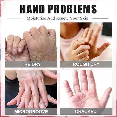 Roses & Milk Hand Repair Gloves, 5 Pairs Hydrating Hand Masks for Dry Cracked Hands, Moisturizing & Softening Gloves for Women & Men, Nourishing Hand Spa Treatment