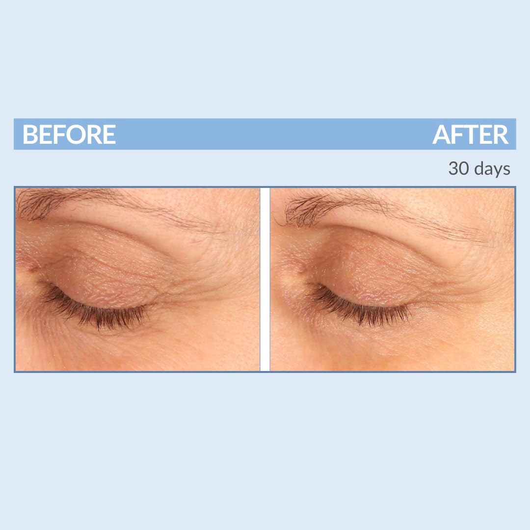 Serious Skincare - EYETALITY Morning Under Eye Cream for Dark Circles & Puffiness, Anti-Aging Daily Wrinkle Cream, Line Smoothing Skin Care Treatment for Women and Men - Coffee Bean Extract 0.5 oz