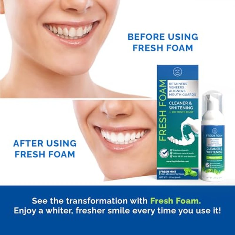 Aligner & Retainer Cleaner Fresh Foam ? Dry Mouth Relief, Compatible with All Clear Aligners, Retainers, Mouth Guards, Night Guards, Veneers, Whitens, Freshens, 3% Hydrogen Peroxide, Mint - 50ml 3pcs