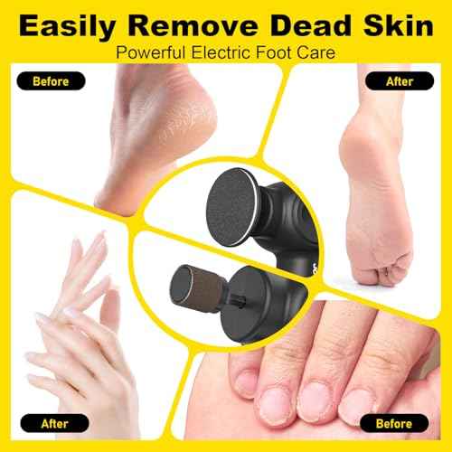 Electric Foot Callus Remover Rechargeable, Electronic Foot File Pedicure Tool, 2 in 1 Foot Grinder, Pro Foot Scrubber Kit for Dead, Hard, Cracked Skin, with 6 Speeds & 20 Sandpaper Discs
