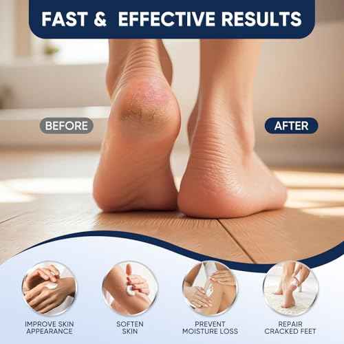 Urea Cream 40 Percent for Feet Maximum Strength, Urea Cream 40% Plus Salicylic Acid 2%, Foot & Hand Cream for Dry Cracked