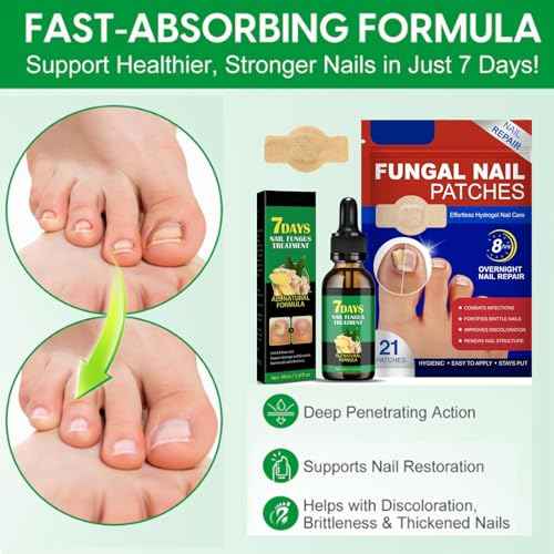 Fungal Nail Patches & Ginger 7 Days Nail Treatment ? Daily Nail Support for Stronger, Clearer Looking Nails ? Easy-to-Use Hydrogel Patches + Natural Formula, 21 Patches & 30ml