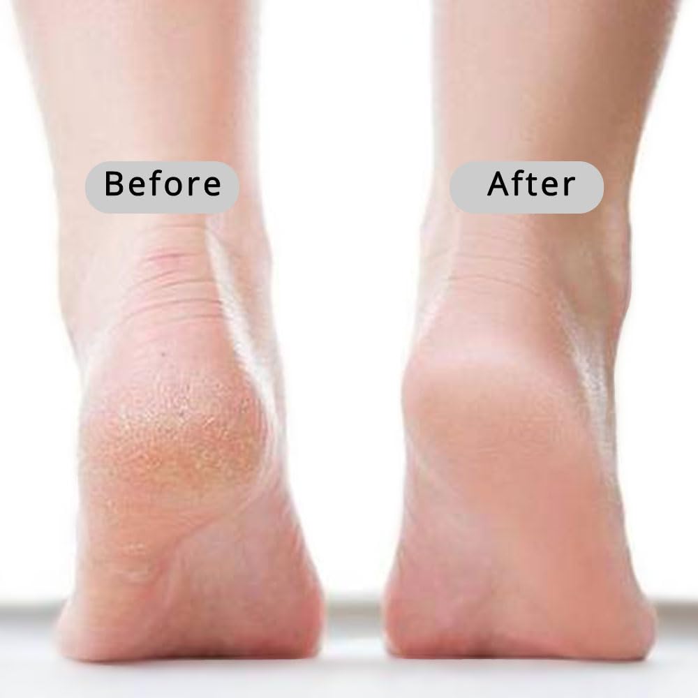 CopesFuda Curved Handle -13.7" Pumice Stone - Ergonomic Non-Slip Foot Scrubber for Shower - Easy Reach Callus Remover & Pedicure Tool for Cracked Heels & Smooth Feet