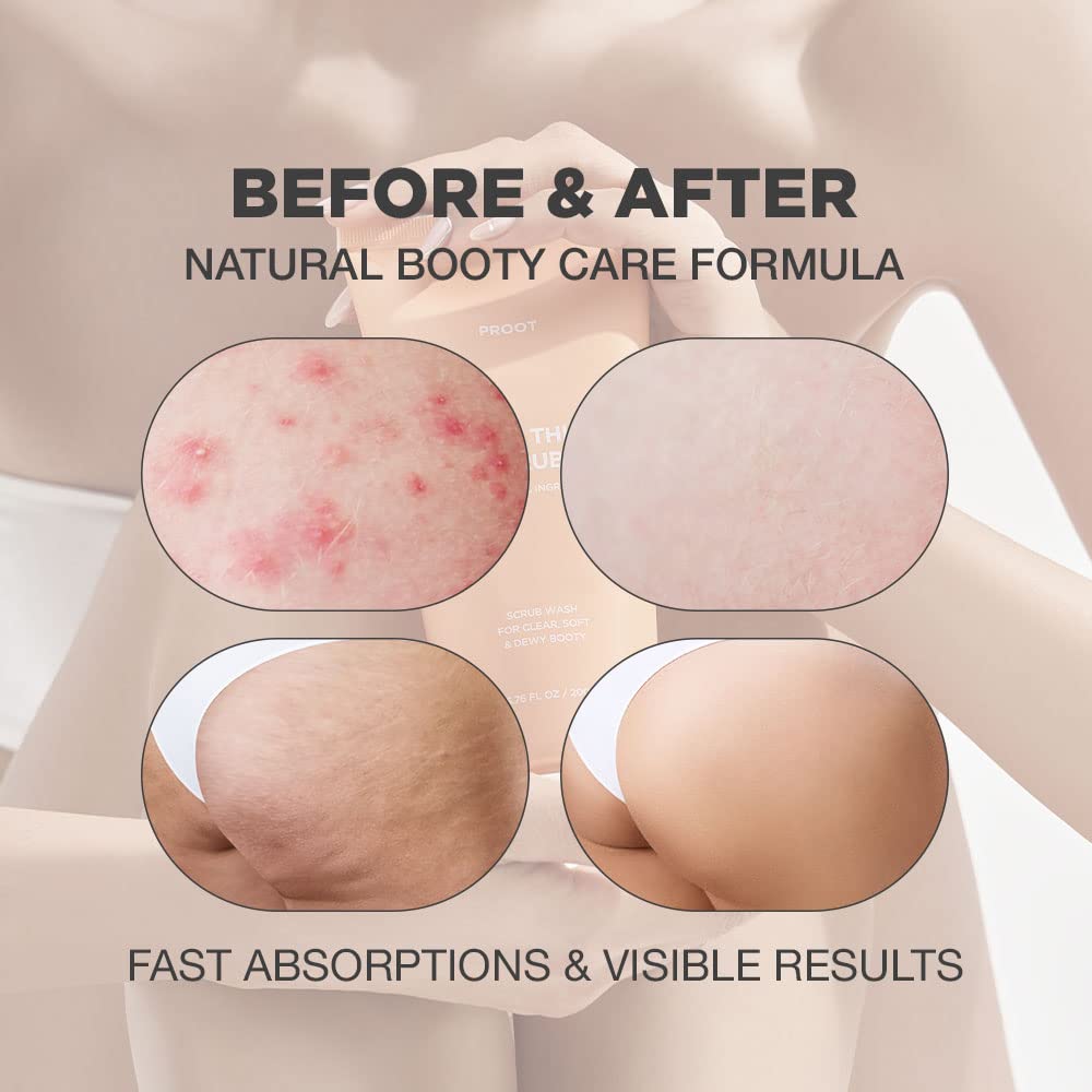 Butt Scrub Wash and Butt Acne & Ingrown Hair Treatment Serum | AHA & BHA Butt Acne and Ingrown Hair Treatment For Bikini Area | Get rid of Butt Acne, Ingrown Hair, Back Acne, Strawberry Legs
