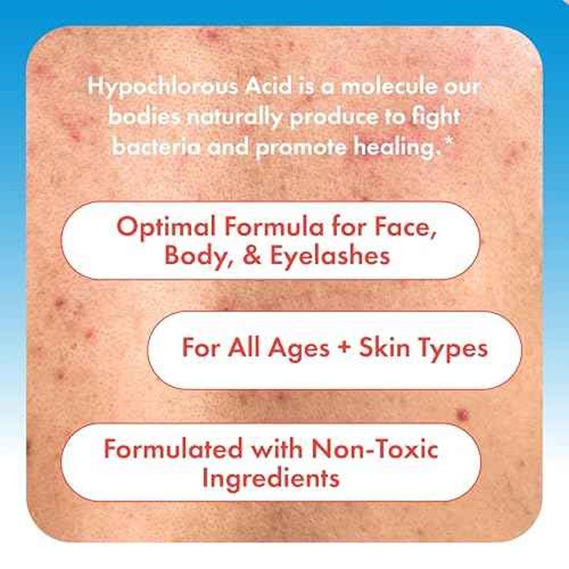 Hypochlorous Acid Spray for Face, Skin & Eyelids ? pH-Balanced HOCl Facial Spray Safe for Acne, Red & Sensitive Skin ? Gentle Non-Toxic Toner & Cleanser Mist for Clear, Hydrated Skin, 8 oz