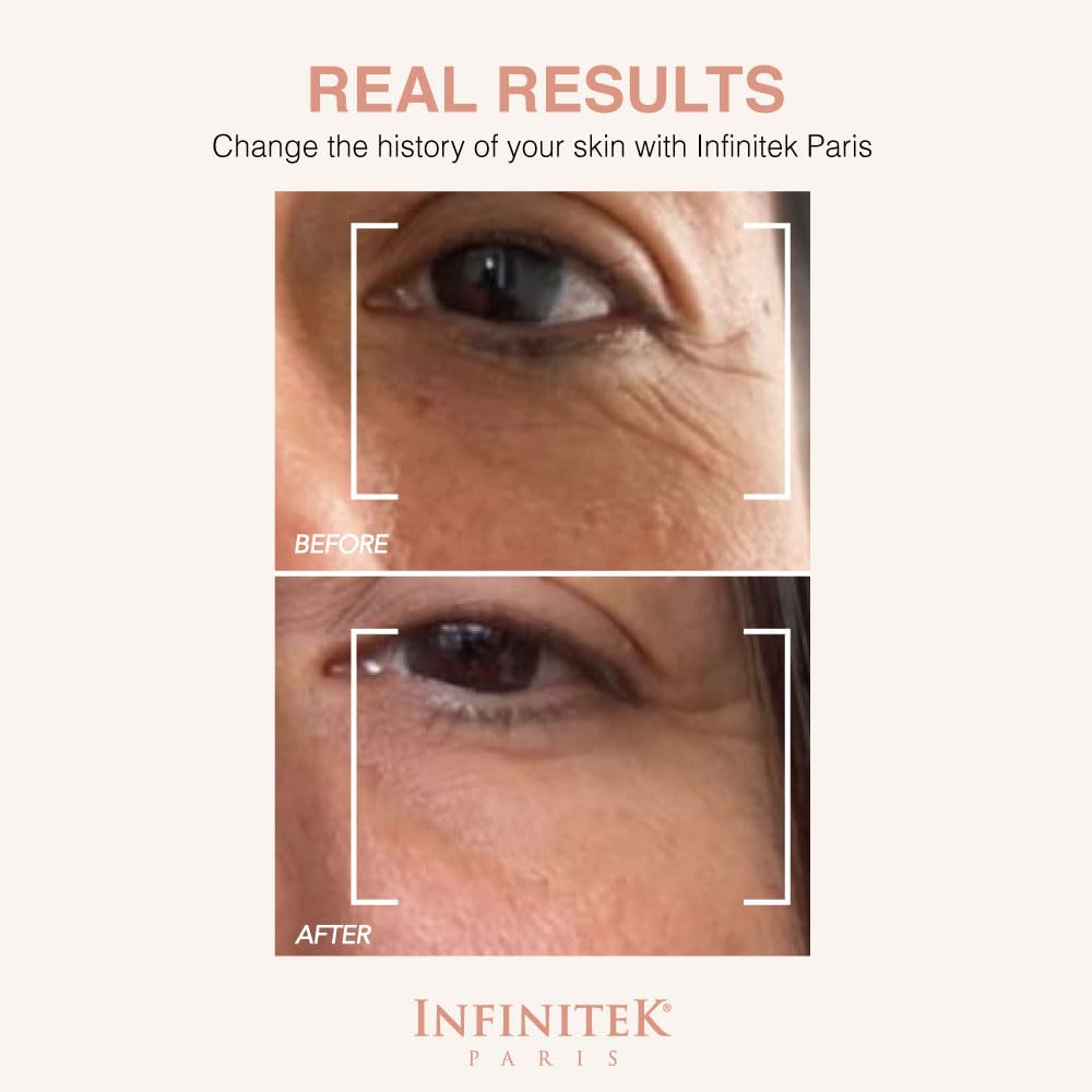 Infinitek Paris Multi-Active 360 Eye Cream | With Caffeine 3%, Retinol & Hyaluronic Acid | Under Eye Cream to Hydrate, Brighten & Reduce Dark Circles, Puffiness, and Fine Lines | 0.50 fl oz / 15 ml