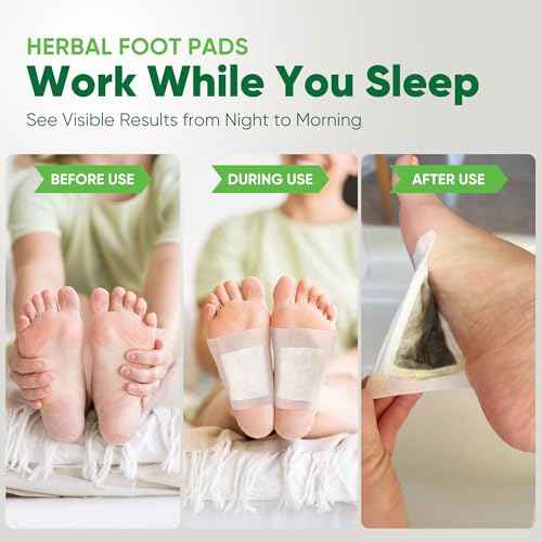 Natural Cleansing Foot Pads - Premium Foot Care - Relieves Stress and Fatigue - Improves Sleep and Supports Body Cleansing - 30 Pads