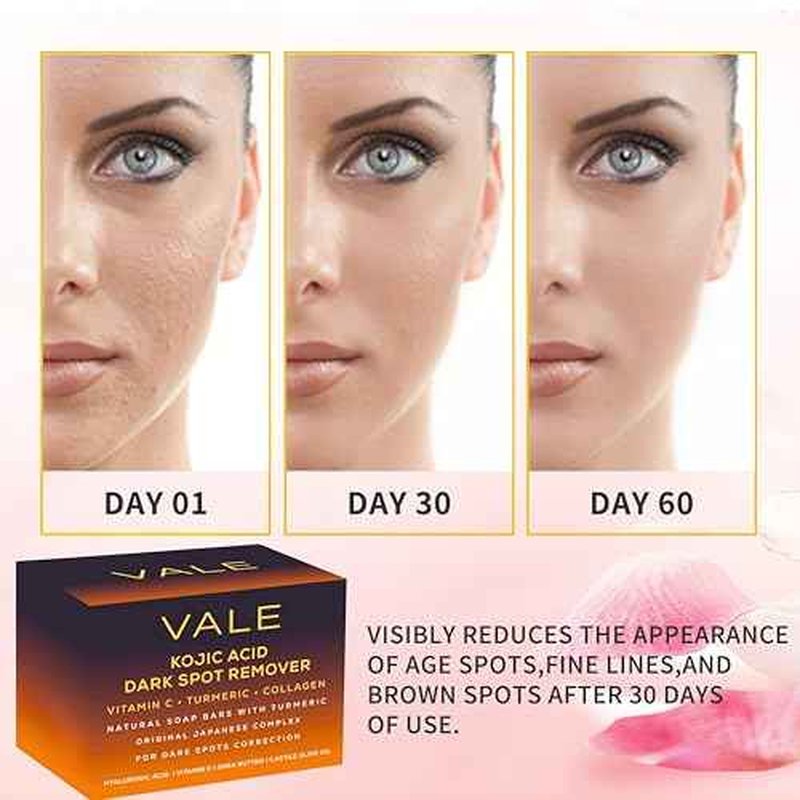 VALE Kojic Acid & Turmeric Soap Bars (1-Pack) ? Natural Dark Spot Remover & Original Japanese Complex with Vitamin C, E, Collagen, Hyaluronic Acid, Retinol, Olive Oil & Shea Butter(Citrus)