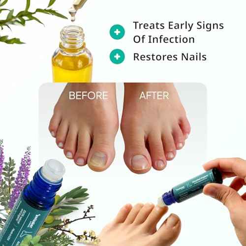 Swissklip Medi-Care Toenail Stick I KlearNail Treatment | Natural Solution for Healthy Nails I Suitable For Foot, Toe, and Fingernail I For Brittle Toenails ? 10ml / 0.3 Fl. Oz. Pack 3 - Made in USA