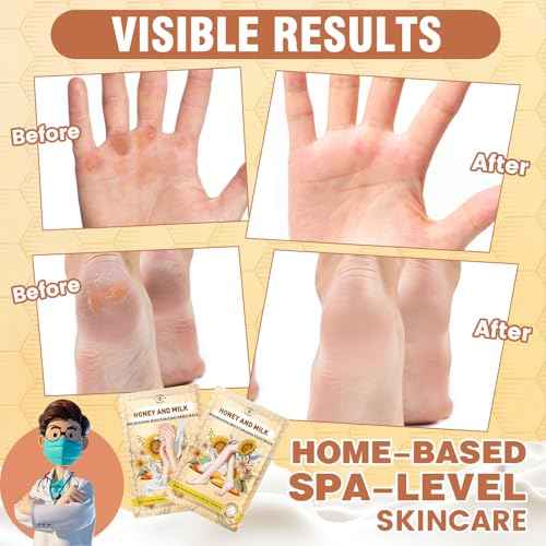 18 Pairs Moisturizing Hand & Foot Masks with Honey, Milk, Vitamin E & Glycerin, Intensely Hydrating Foot Mask for Dry Cracked Feet, Moisturizing Socks for Cracked Heel Treatment