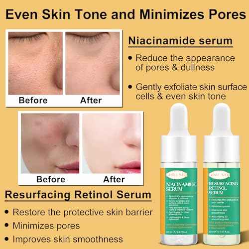 Skin Care Set for Women Teen 6 Pcs - Hydrating & Anti-Aging Facial Routine Skincare Products,Cleanser,Toner,Retinol Serum,Niacinamide Hyaluronic Acid Serum & Face Cream - Gifts Women Christmas