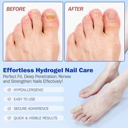 Nail Patches, 8-Hour Overnight Treatment, Fast-Acting Toenail Repair Patches, 21 Count